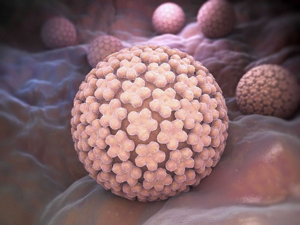 príčiny HPV